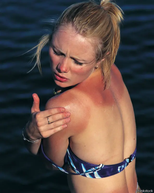 آنچه در تصویر دیده می‌شود از نظر پزشکی آفتاب سوختگی است که برای سلامت پوست مضر است