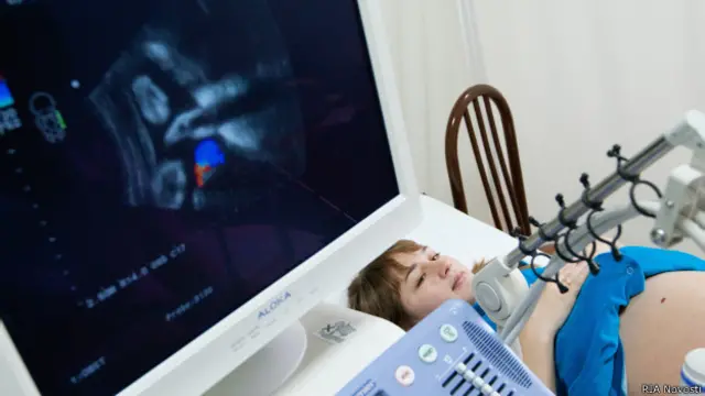 Женщина на узи