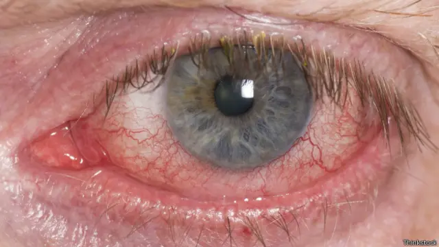 Ojos rojos lentes de contacto 2025