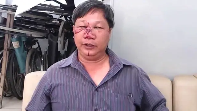 Ông Đinh Quang Tuyến là nạn nhân mới nhất của tình trạng bạo lực với các nhà hoạt động