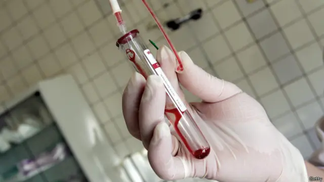 Todos los expertos coinciden en que el principal objetivo de una política global sobre el tema debe ser el de persuadir a la gente para que se someta a la prueba del VIH.