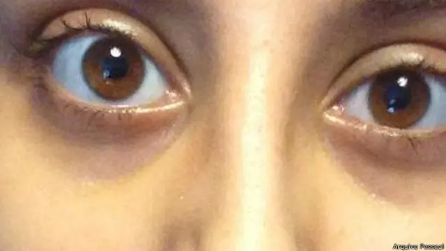 Jessica após passar por tratamento intensivo e deixar o hospital