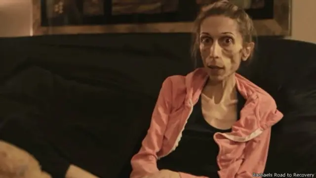 La campaña "Rachael's Road to Recovery" ha conseguido recaudar más de los US$100.000 necesarios para su tratamiento.