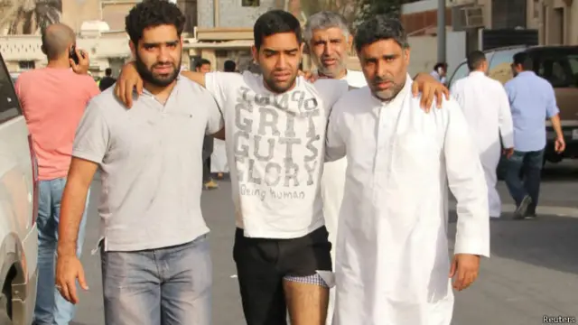 По данным министерства здравоохранения, в результате взрыва ранены более 100 человек