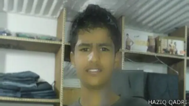 कश्मीर हामिद आंख बेकार