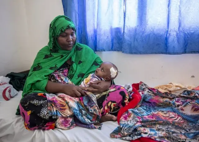 हरगेसा में महिलाओं का अस्पताल