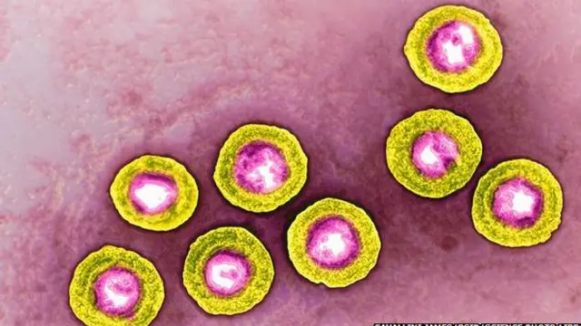 یہ میلانوما کا پہلا علاج ہو گا جس میں کوئی وائرس استعمال کیا جائے گا