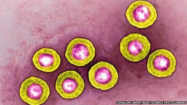 Genetiği değiştirilen herpes virüsü denemelerde olumlu sonuç verdi.