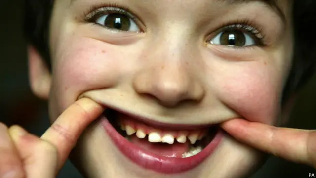 只有五分之二的英国少年儿童可被列为口腔卫生良好。它的标准是没有龋齿、牙齿损坏或牙垢。