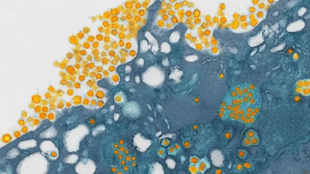 显微镜下的中东呼吸综合征（MERS）病毒