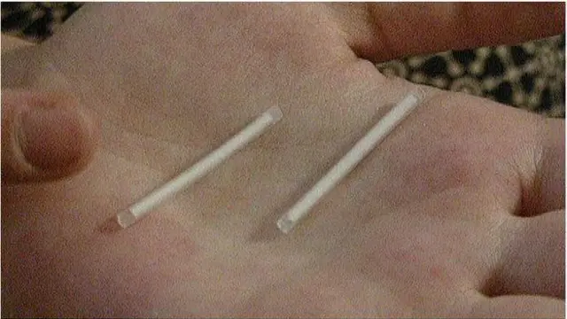 Kenyalı kadına yerleştirilen implantlar.