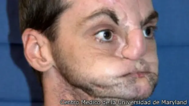 Richard Norris tras el accidente 