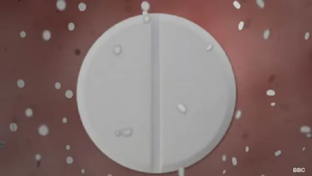 امریکہ میں آپریشن کے بعد انفیکشن پیدا کرنے والے نصف کے قریب جراثیم میں اینٹی بائیوٹک ادویات کے خلاف مزاحمت پائی جاتی ہے