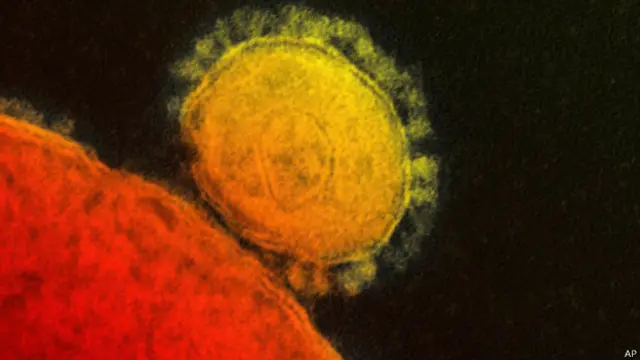 Virus MERS berasal dari keluarga koronavirus yang meliputi virus flu dan SARS, dan dapat menyebabkan demam, gangguan pernapasan, pneumonia dan gagal ginjal.