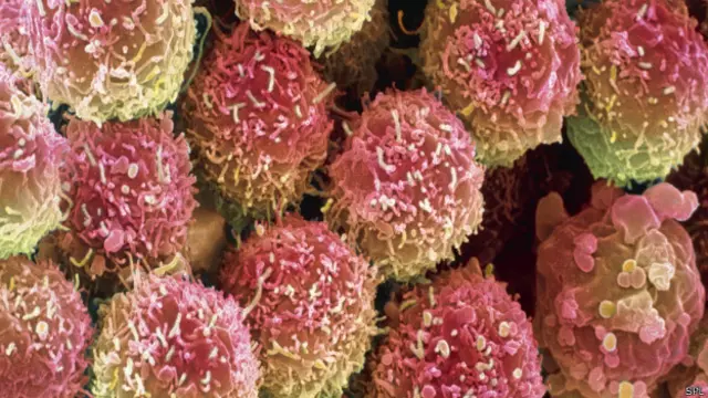 புற்றுநோய்க்கலங்கள்