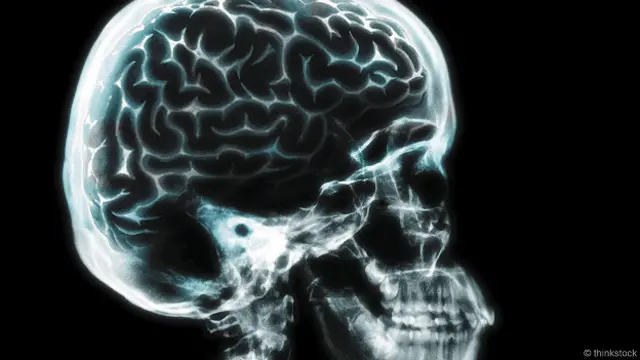 Чтобы проникнуть внутрь чужой головы, не нужно делать рентгеновский снимок