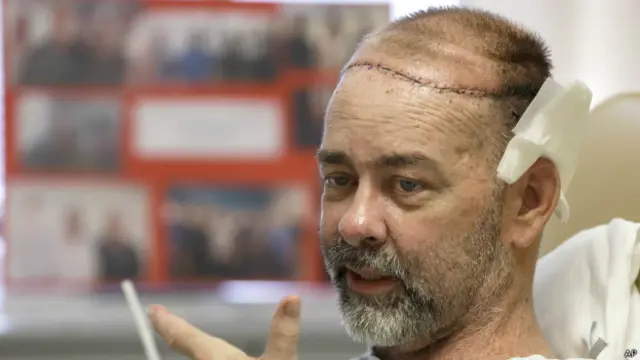 ڈاکٹروں کے مطابق یہ کام انھوں نے 15 گھنٹے کے طویل آپریشن کے دوران انجام دیا