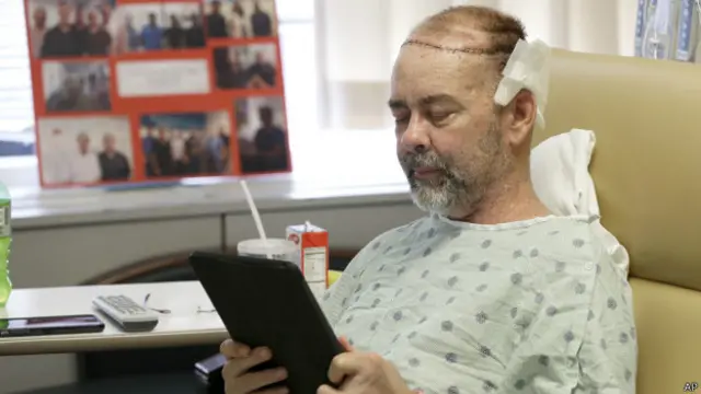 جیمز بوئسن اب مذاق میں کہتے کہ اب ان کے سر پر اب اس وقت سے زیادہ بال ہیں جب وہ 21 سال کے تھے