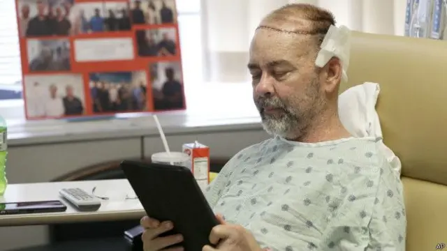 جیمز بویسن له عملیاتو وروسته، د ټوکې په ډول وویل، اوس مې پر سر دومره ویښتان دي چې په ۲۱ کلنۍ کې هم دومره نه وو: