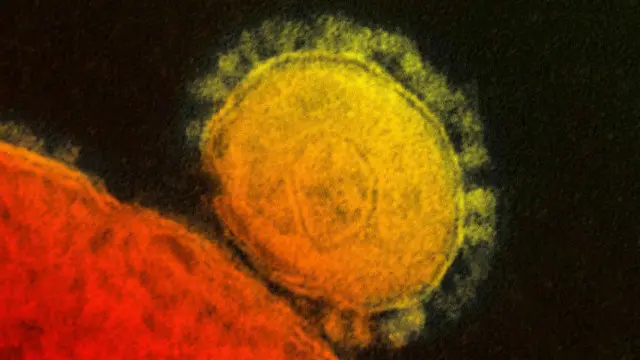 MERS sudah menulari 1400 orang dan memakan 500 korban tewas sejak 2012