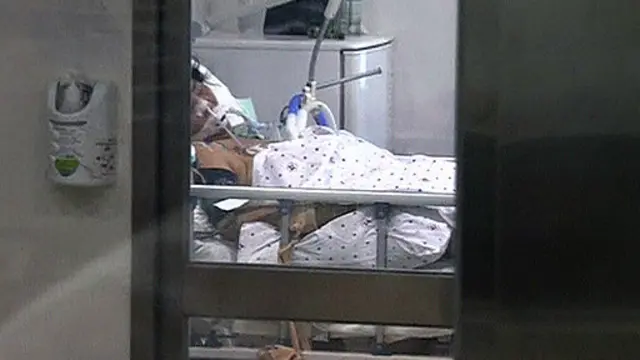 Sejauh ini sebanyak 14 pasien telah meninggal dunia dan 138 lainnya telah terjangkit virus MERS di Korsel.