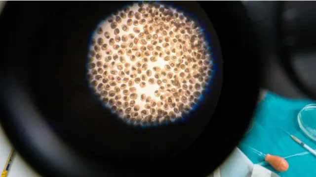 جگر کے سرطان کی بلند شرح کا تعلق کچی مچھلی میں موجود ایک پیراسائیٹ لیور فلوک سے ہے