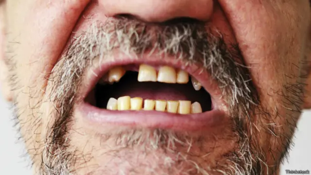 Очень плохие зубы