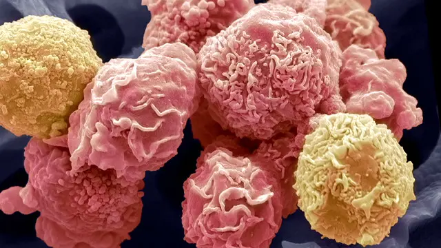 التشخيص المبكر للمرض يقلل من مخاطره