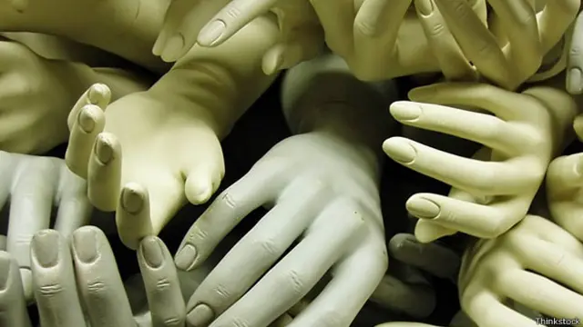 Протезы рук