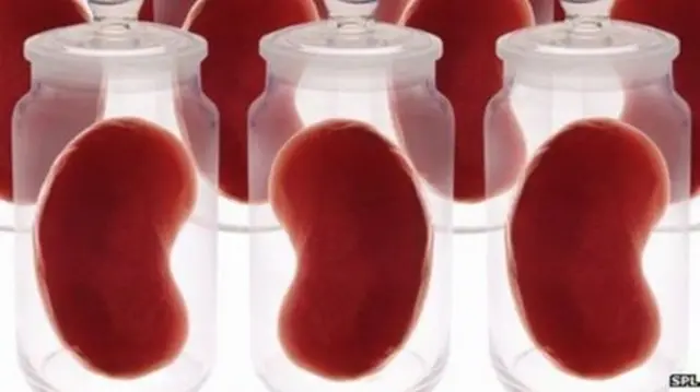 مسلمان ناروغان د نورو پرتله د بدن غړو بسپنې ته په منځنۍ کچه یو کال زیات انتظار باسي.