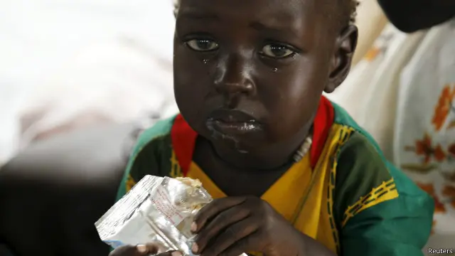 طفل من اللاجئين من جنوب السودان في مركز صحي في إثيوبيا.