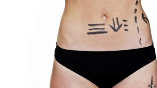 整形手术使人们可以整得更接近理想中的容貌——但,是谁的理想呢?(图片:Getty Images)