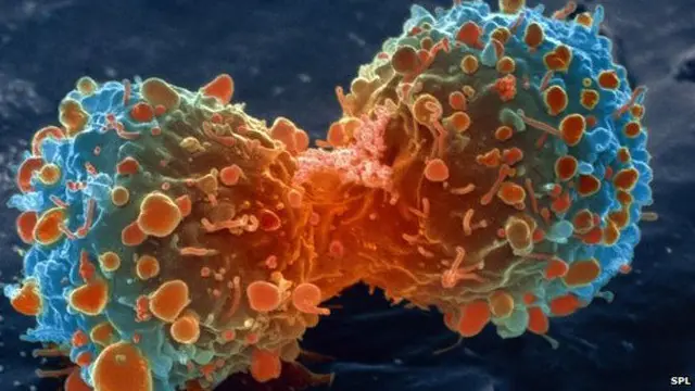 يكلف مرض سرطان الأمعاء أربعة أضعاف التكاليف في مراحل التشخيص المتأخرة مقارنة بالتكاليف عند اكتشافه في مرحلة مبكرة.