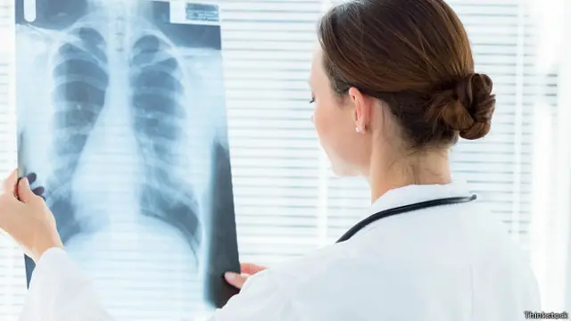 Врач с рентгеновским снимком