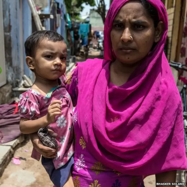 तीन साल की फातिमा इतनी कमज़ोर है कि उसे गोद में उठाना पड़ता है