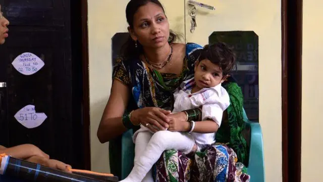 Mantener los pies enyesados es parte del tratamiento del método Ponseti.