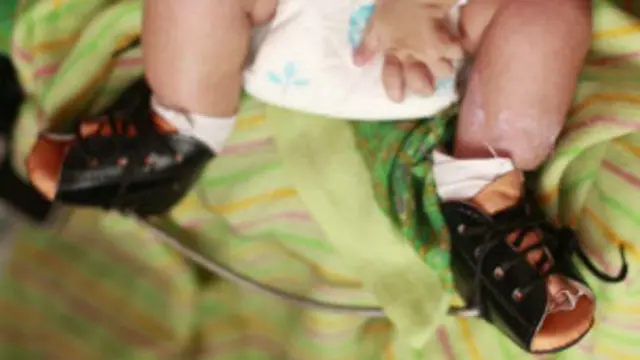 Algunos diseños de soportes ortopédicos actualmente usados resultan incómodos.