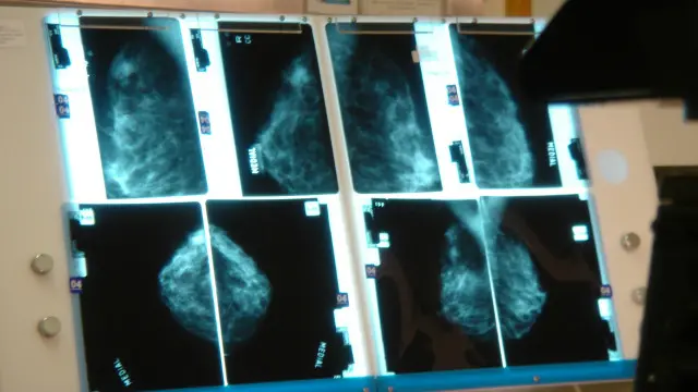 Ayollarning eng uzun kokrak uchlari Ayollarning eng uzun kokrak uchlari