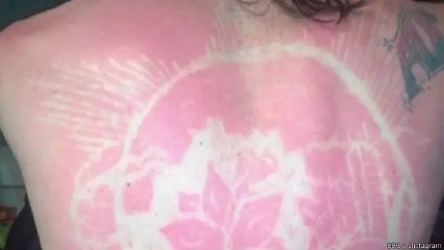 Las quemaduras de sol y las plantillas crean efectos como el que se ve en la fotografía.