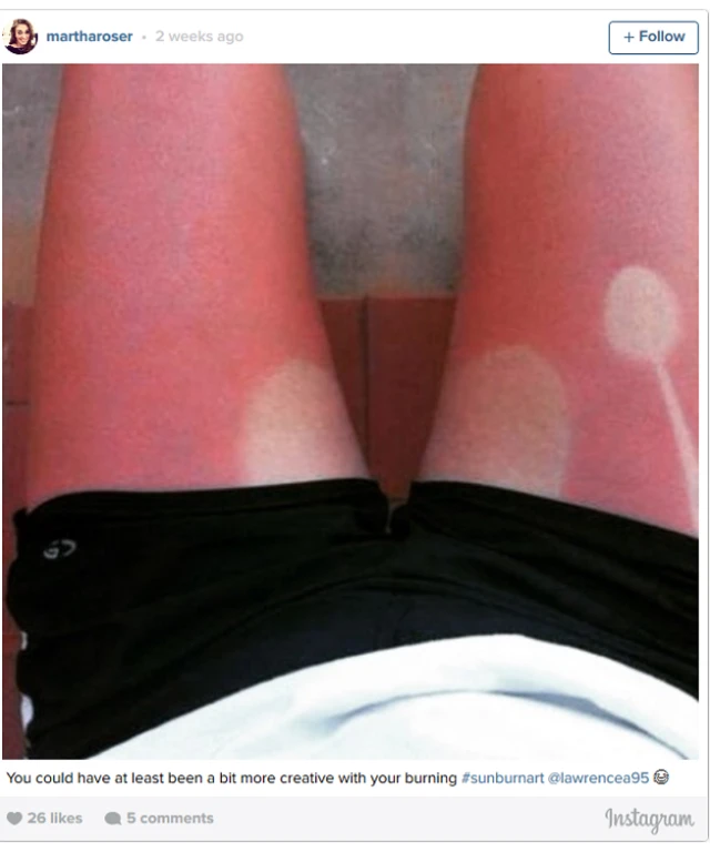 Una diversión de un momento como este tatuaje solar, puede dejar daños irreparables en la salud.