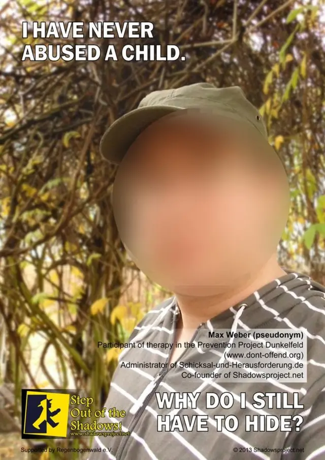 Max participou do tratamento e diz que processo foi doloroso, mas eficaz