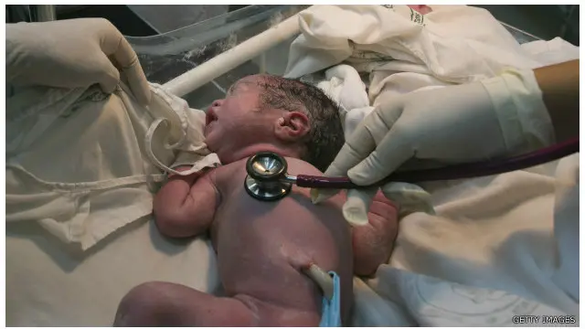 د جراحي عملیاتو له لارې زیږون، ماشوم ته دموردشیدو د لږ ورکولو او پرما شوم نورو منفي اغیزو سره تړاو لري