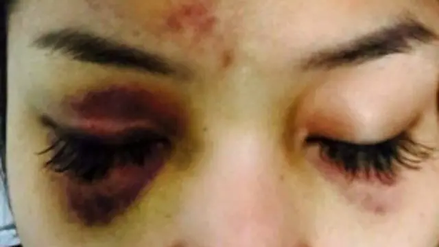 SaSa ရဲ့ ဓါတ်ပုံတွေ အင်တာနက်မှာ ပျံ့နှံ့ ခဲ့