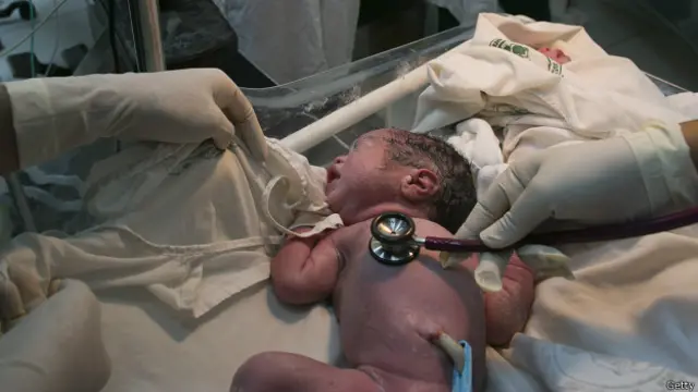 Ребенок, родившийся путем кесарева сечения