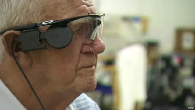 बॉयोनिक आई