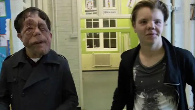 एडम और उनके दोस्त ल्यूकास