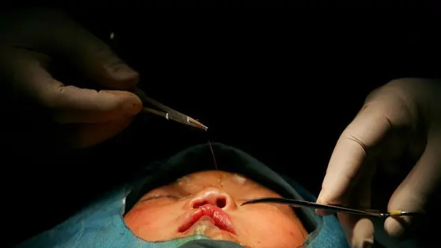 குணப்படுத்தக்கூடிய இந்த நோயின் காரணமாக, குழந்தைகளைக் கைவிடும் போக்கு சீனாவில் அதிகமாக உள்ளது.