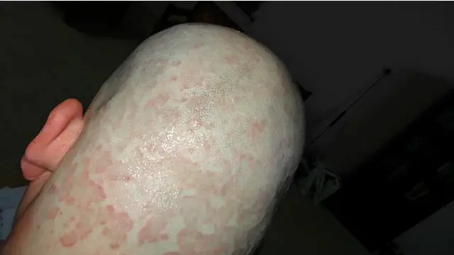 तमीम के सिर का मुंडन