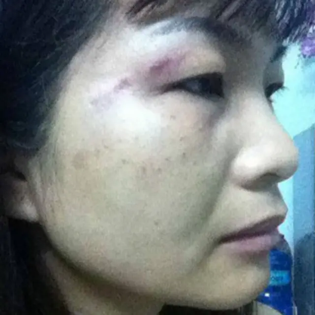 Nhà hoạt động Trương Hoàng Anh cũng bị 'đánh'