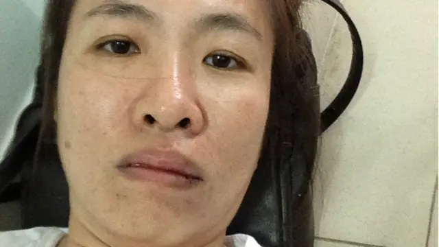 Cô Như Quỳnh nói cô bị hành hung chảy máu miệng